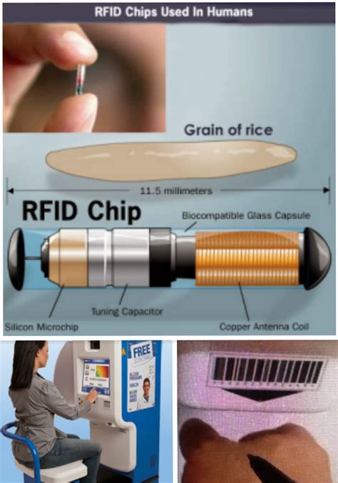 affordable care act rfid chip|rfid implantation.